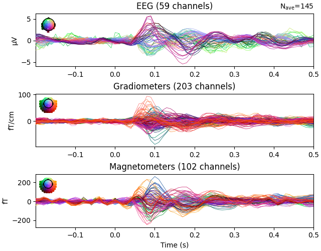 EEG (59 channels), Gradiometers (203 channels), Magnetometers (102 channels)